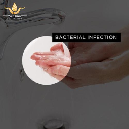 bệnh về móng và cách xử lý - baogiadinh.vn