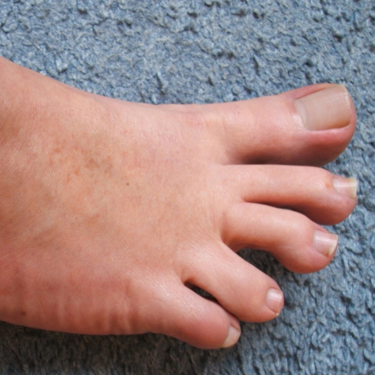flickr-andy_5322 - lamnails.Net