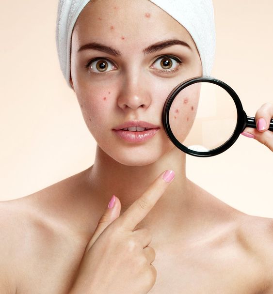 Các sản phẩm chăm sóc da mặt trị mụn được ưa chuộng nhất