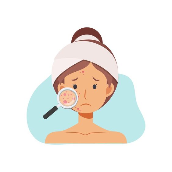 Một số cách chăm sóc da mặt không bị mụn và dầu nhờn